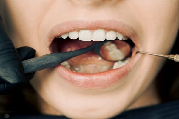 intarsi dentali