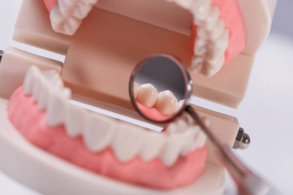 parodontologia roma